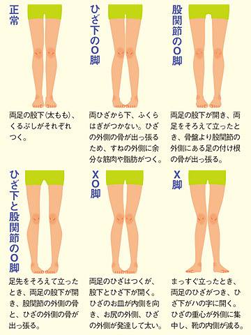 ( *´艸｀)　整体のちょっと豆知識　～その八～　Ｏ脚